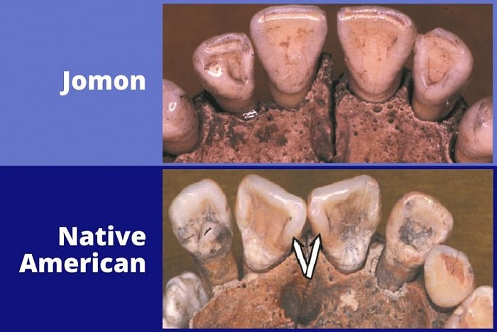 Jomon-and-Native-American-Teeth-777x518.jpg