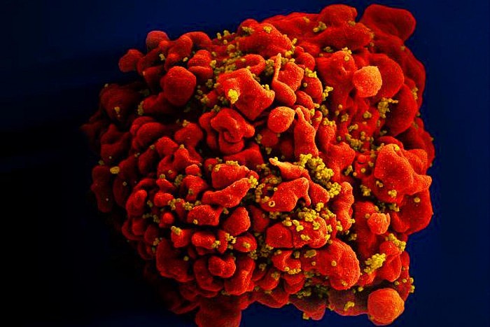 HIV-Immune-Cell.jpg