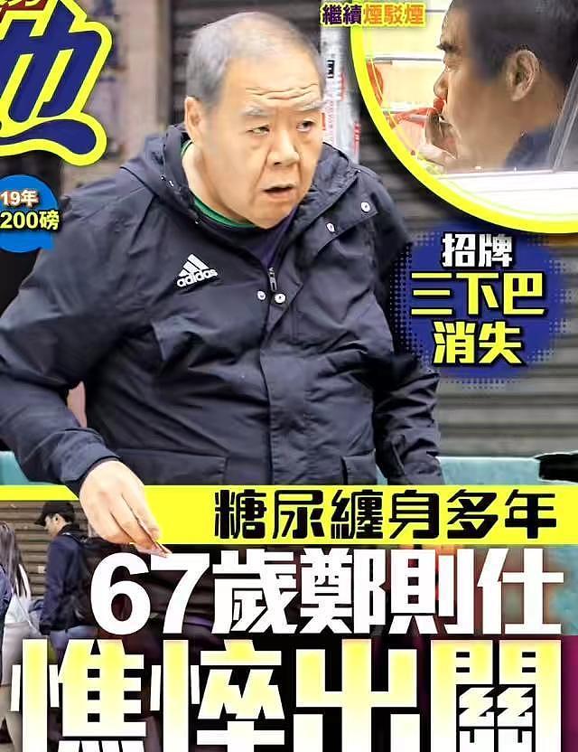 67岁肥猫郑则仕被病折磨，身形消瘦掉发严重，头发花白似80岁 - 3