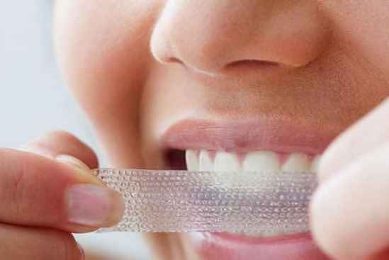 牙贴真的能美白牙齿吗 牙贴的使用方法 - 3