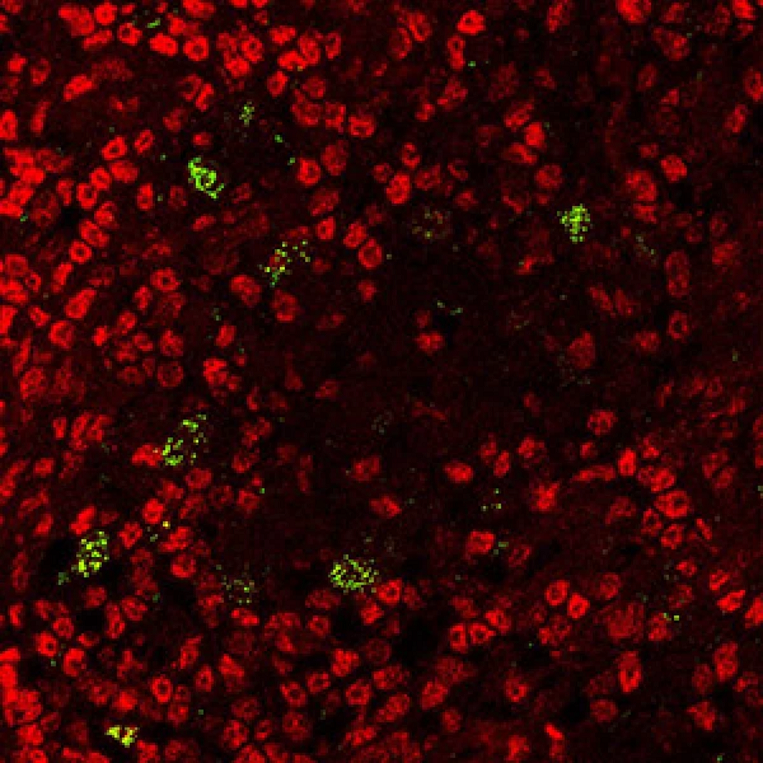 研究：阻断胸腺的KAT7酶可对抗自身免疫性疾病和癌症 - 1