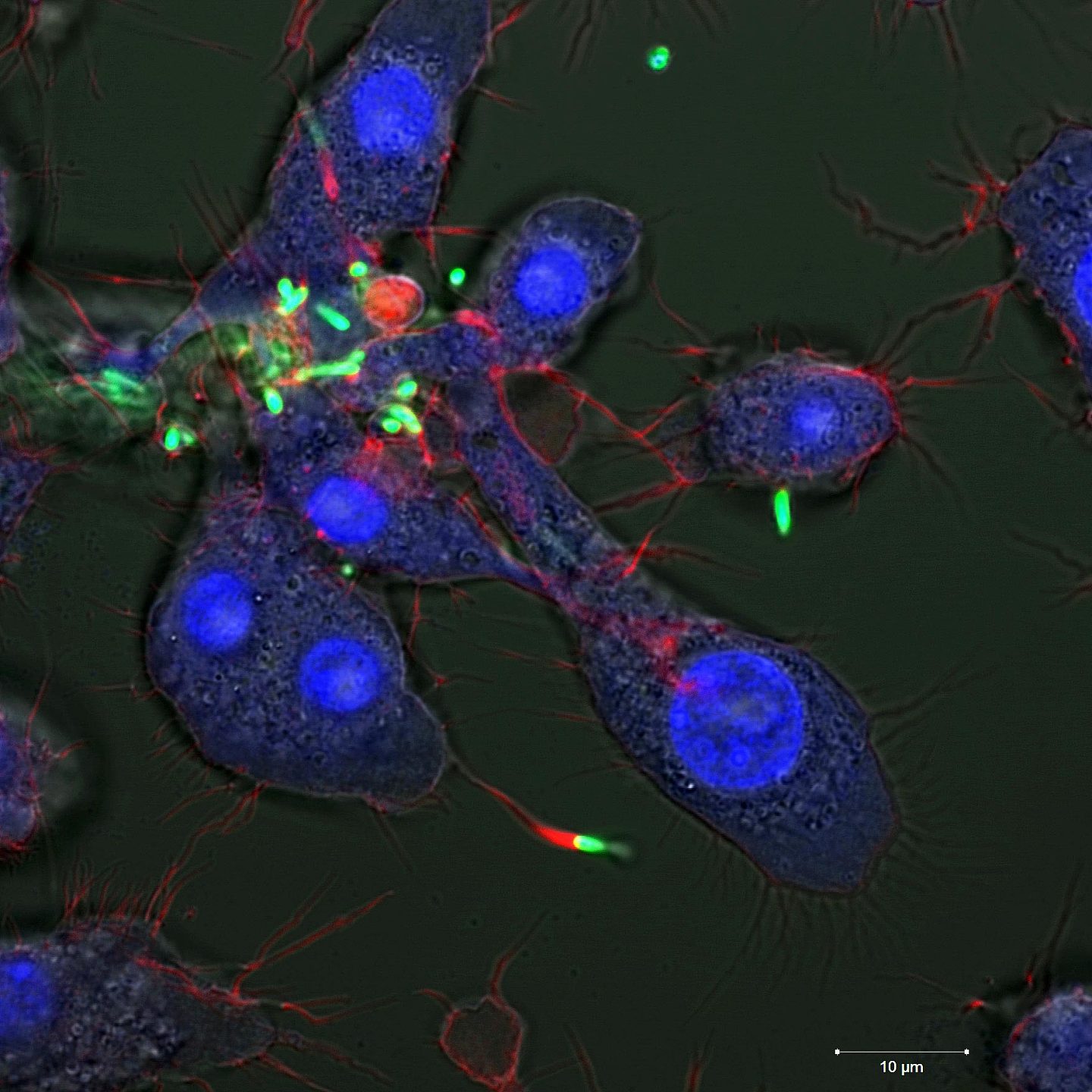 研究人员利用纳米粒子杀死隐藏在人类细胞内的危险细菌 - 1