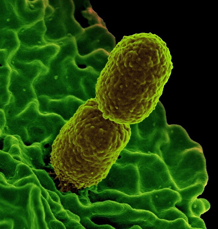 20210115-bacteria.jpg