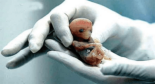 当实验室里的人类胚胎长出心脏，是进步还是灾难？ - 2