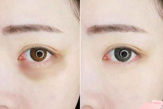 维生素e加凡士林可以去眼纹吗 怎么用去眼纹 - 2
