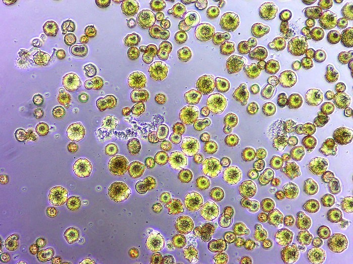 Pollen-With-Acinetobacter.jpg