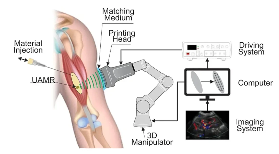 研究人员找到一种通过声波在体内直接3D打印医疗植入物的方法 - 2