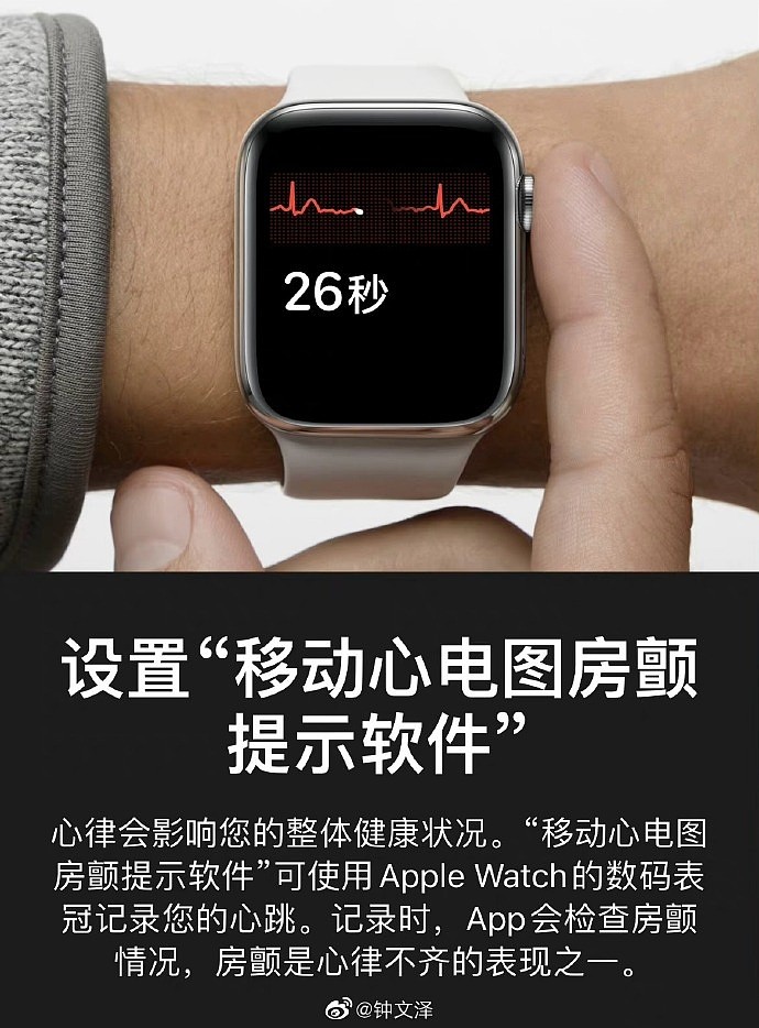 国行Apple Watch终于获得“完全体” ECG心电图已上线测试版系统 - 1