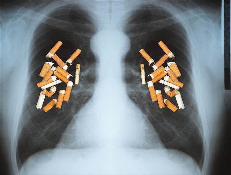 戒烟后，肺部能恢复健康吗？提醒：2种方法自测肺功能，不妨试试 - 3