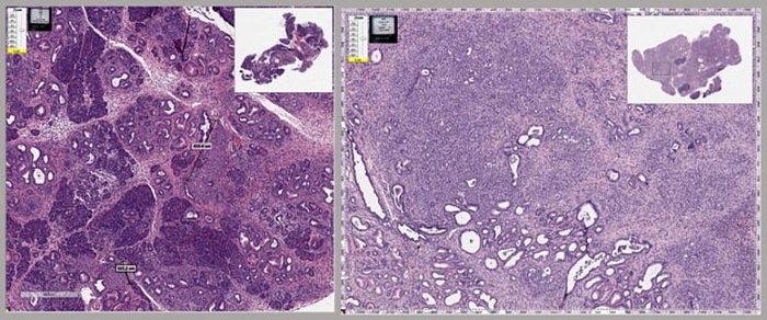 Mouse-Pancreas-With-Cancer-777x324.jpg
