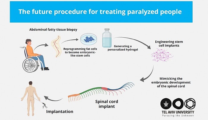 Future-of-Treating-Paralyzed-People.jpg