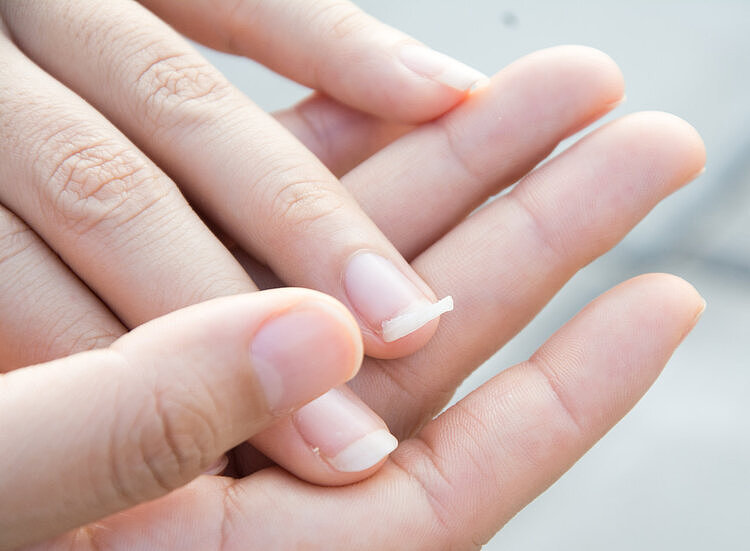 指甲发生这3个变化，是身体的“求救信号”，早发现早治疗 - 4