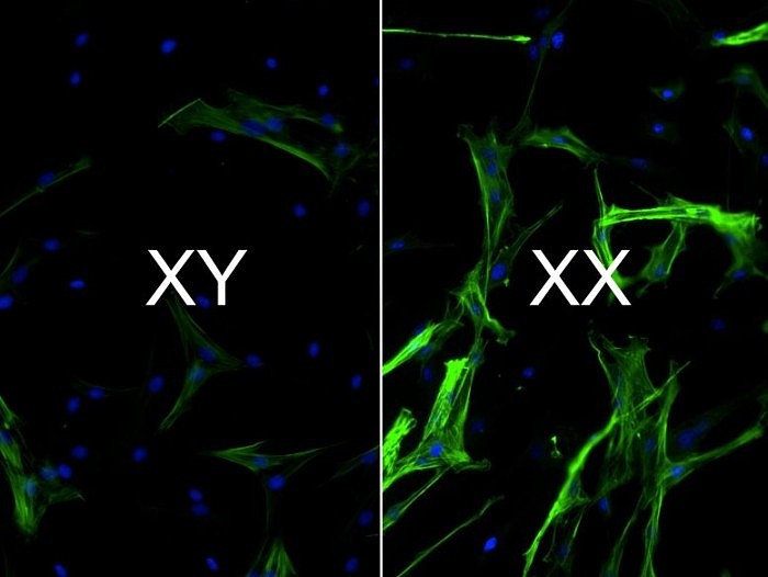 Heart-Tissue-XX-vs-XY-Chromosomes-777x584.jpg