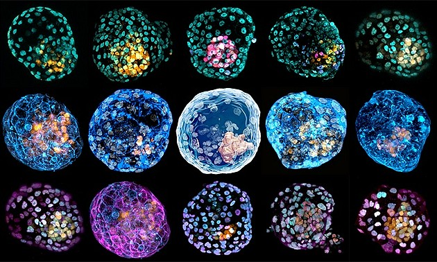 图4：这些模拟囊胚阶段的胚胎模型是从皮肤细胞重编程而来的。