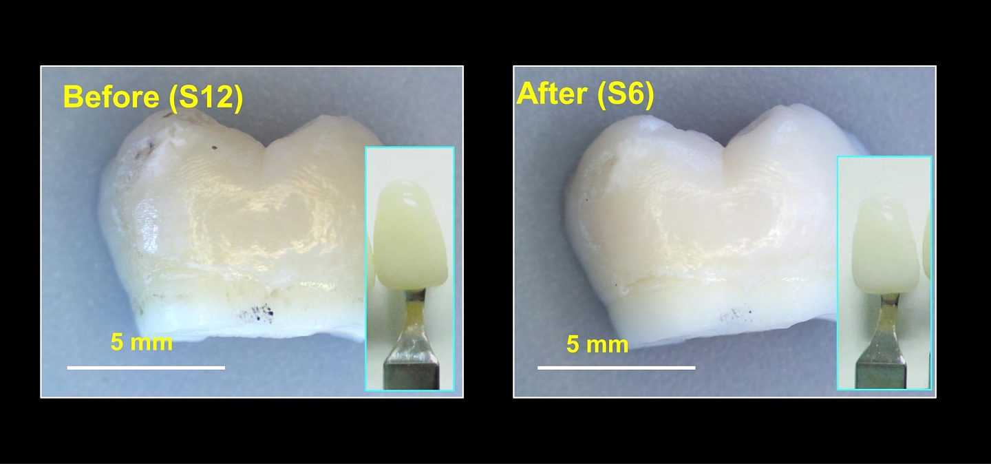 全新凝胶能在不产生灼烧的条件下有效美白牙齿 - 1