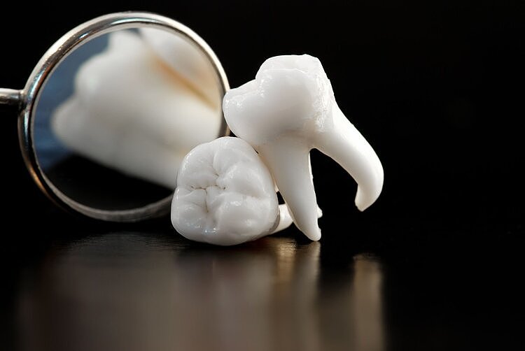 牙缝里的牙结石，如何清除干净？直言：这3个办法是不少人的选择 - 7
