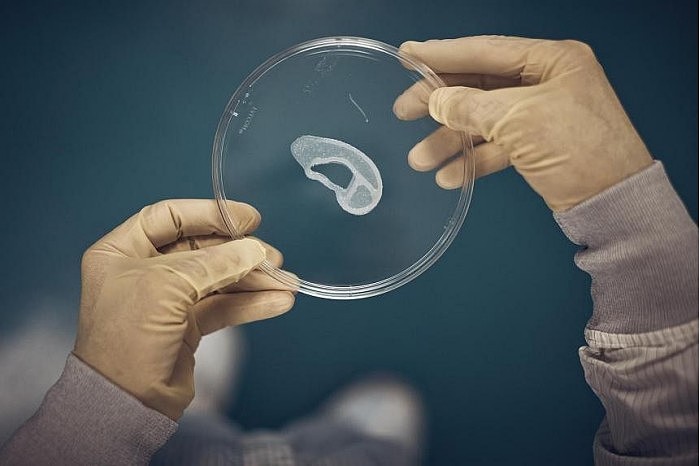 Doctors-transplant-3D-printed-ear-made-of-human-cells-which.jpg