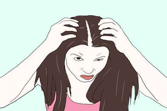 脂溢性脱发是什么症状 脂溢性脱发如何判断 - 3