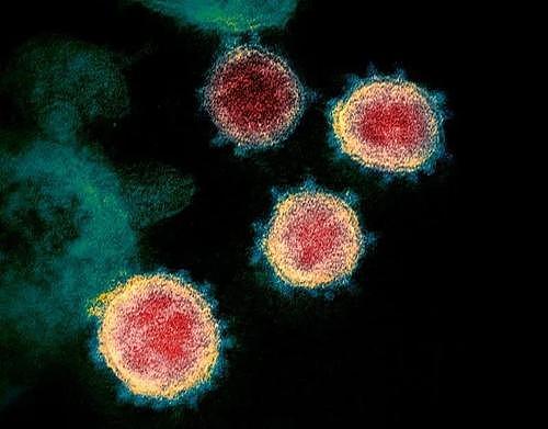 张文宏团队发表论文 证明疫苗异源加强接种可诱导高免疫反应 - 1