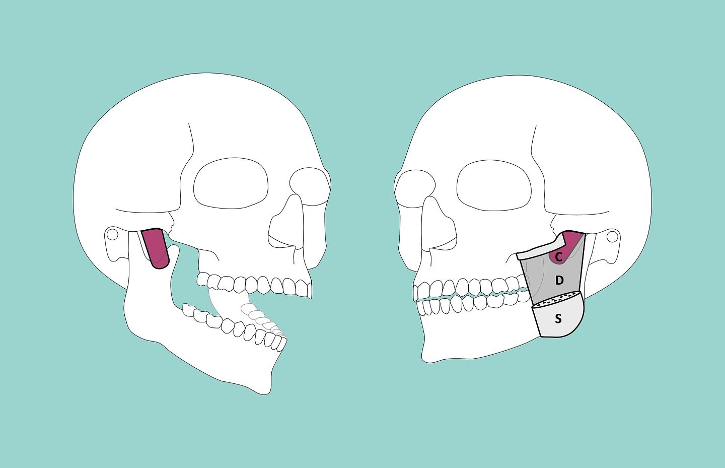 解剖学的惊喜：人类颚部发现新的肌肉层 - 1
