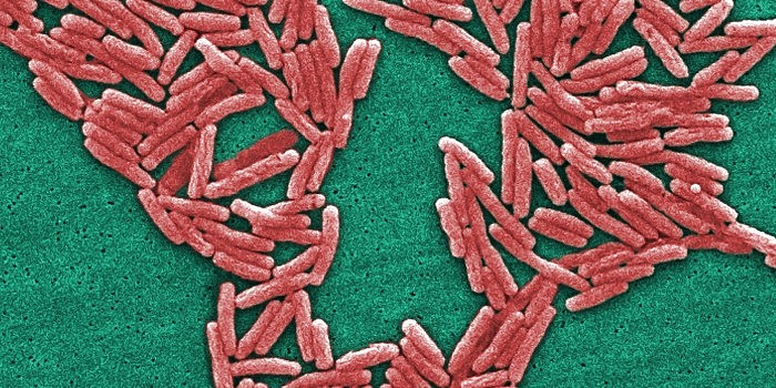 legionnaires-disease-bacteria-today-main-190801.jpg