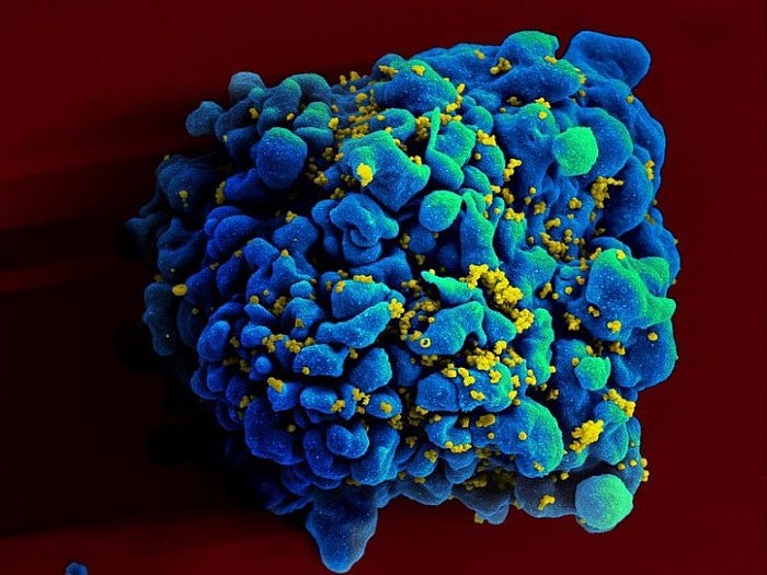 HIV-Infected-H9-T-Cell-777x583.jpg