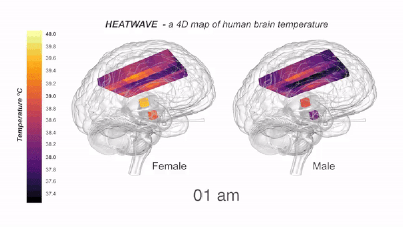 健康人脑部深层温度超40℃ - 2
