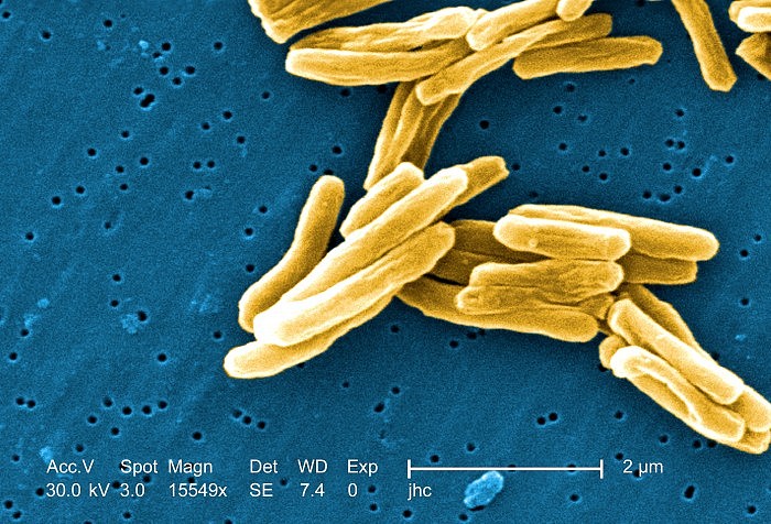 gram-positive-mycobacterium-tuberculosis-bacteria.jpg