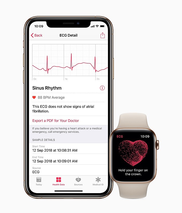 年轻人收到Apple Watch心房颤动早期预警 医生尚未找到最佳应对方案 - 1
