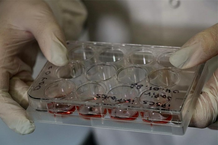 Petri-Dish-With-Tissue-Samples.jpg