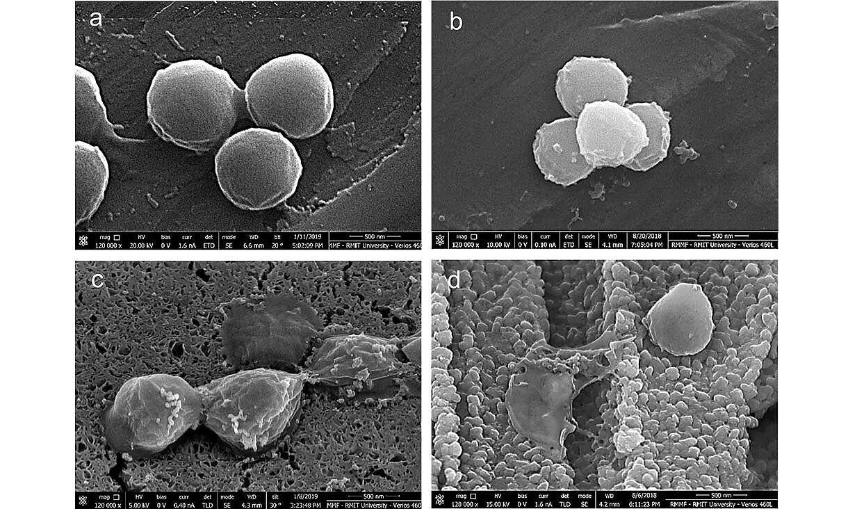 科学家研发出新型多孔铜：杀死金色普通球菌的速度是普通铜的120倍 - 2