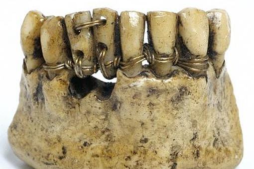 古代人的假牙使用什么做的?古代一些奇葩的事实 - 1