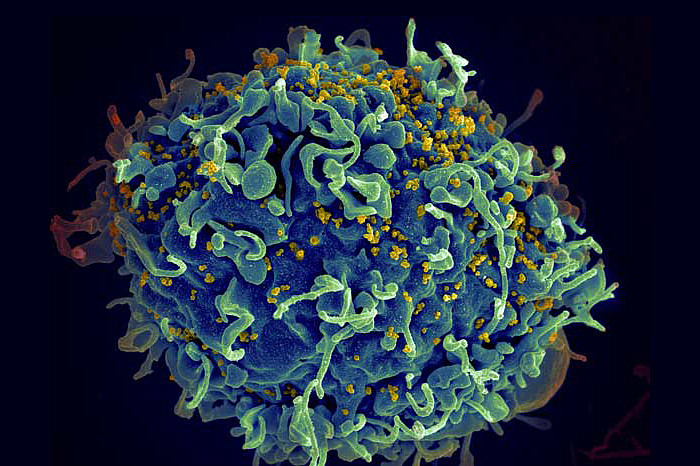 T-Cells-HIV-Virus.jpg