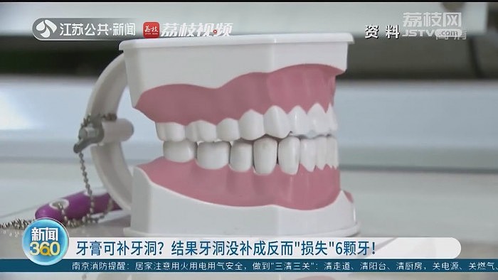 家长轻信网红药：10岁娃用牙洞修复牙膏后损失6颗牙 - 2