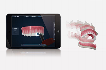 瞄准医学视觉蓝海，「优医视觉」让医学知识“3D交互可视化” - 2