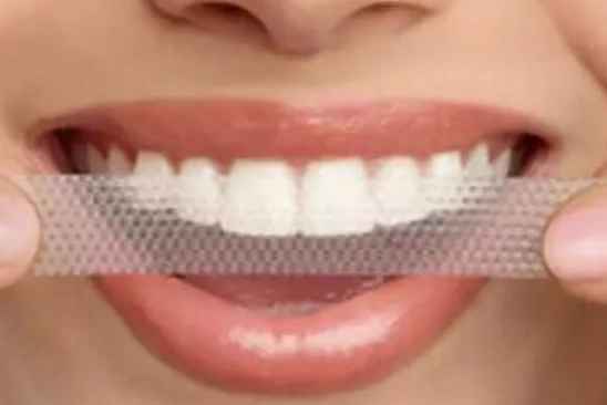 牙贴真的能美白牙齿吗 牙贴的使用方法 - 1