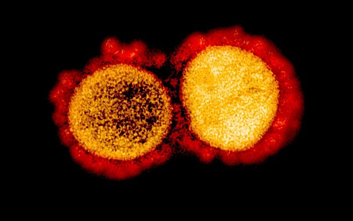 COVID-19-Coronavirus-SARS-CoV-2.jpg