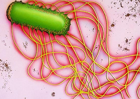 沙门氏菌感染与食物的关系，通常表现为什么？ - 1