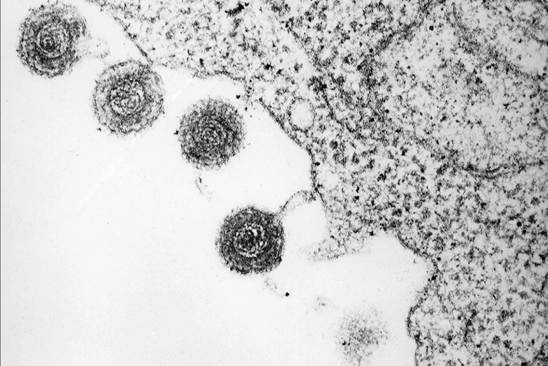 小鼠研究表明病毒感染可导致自身免疫性疾病 - 1