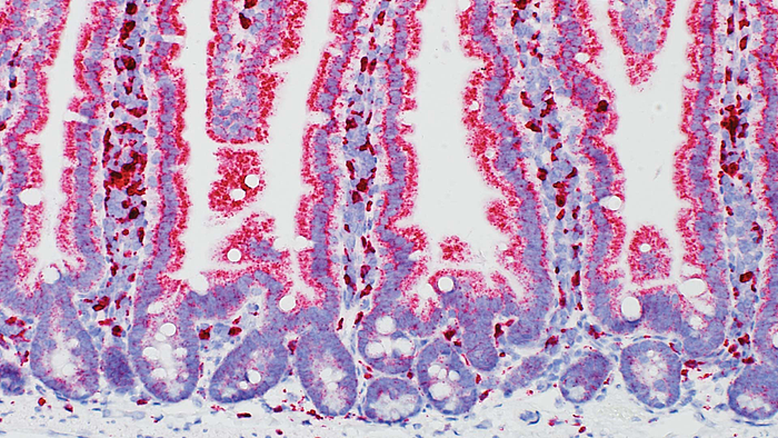 Low-Res_normal-mouse-small-intestine.jpeg.png