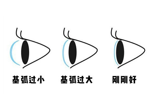 美瞳基弧越大越好吗​ 美瞳基弧多少合适 - 1