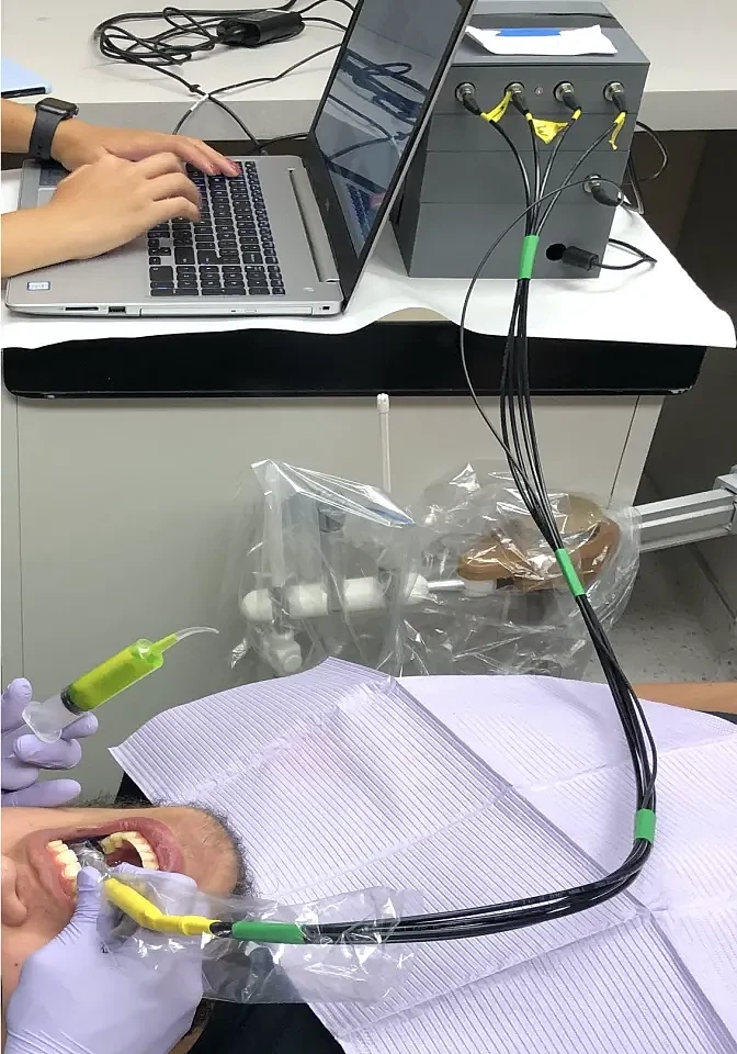 科学家研发新光学设备 可检测蛀牙高危区域 - 2