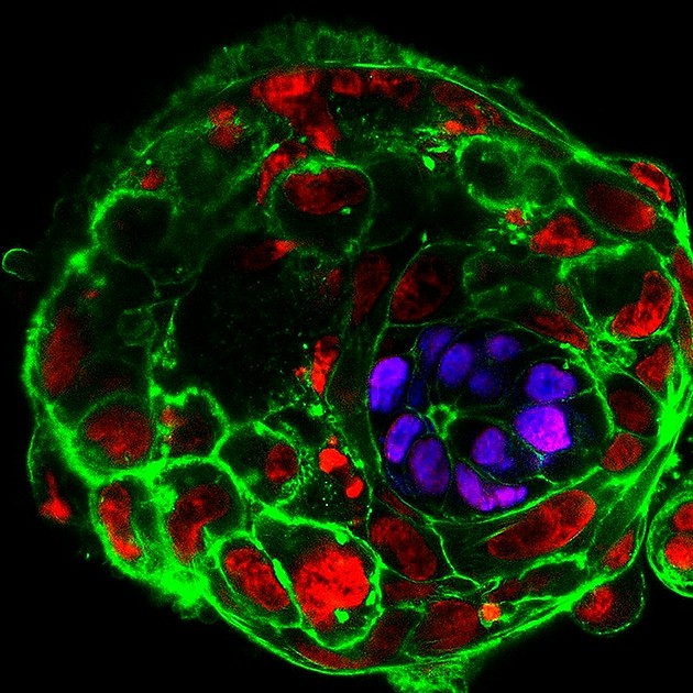 图3：受精十天后实验室培养的人类胚胎，紫色部分为将发展成为胎儿的细胞。