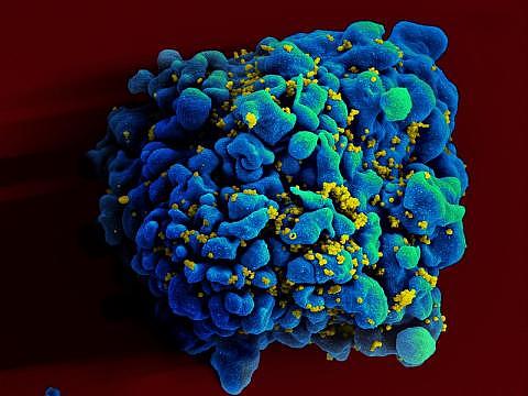 HIV infected H9 T cell.jpg