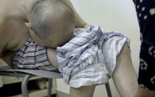 湖南折叠人：45岁男子脸贴大腿、身体折叠180度，16年后迎来新生 - 2