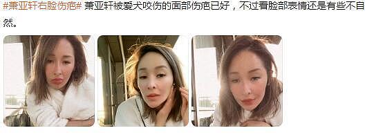 42 岁萧亚轩公开伤情，眼神迷离涣散，右脸明显凹陷触目惊心 - 6