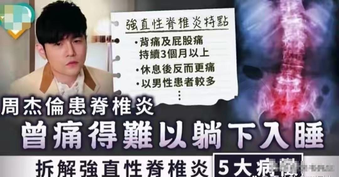 李宇春成名代价多大？隐藏身体秘密曝光，才知后遗症让她苦不堪言 - 16