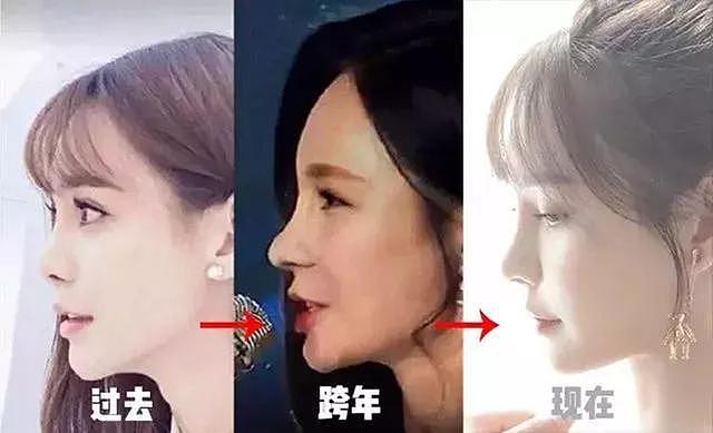 明星整容失败想要回春得多努力？ - 31