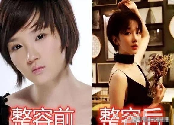 整容上瘾的6位女星，有人“换头改命”爆红，有人却断送了大好前途 - 6