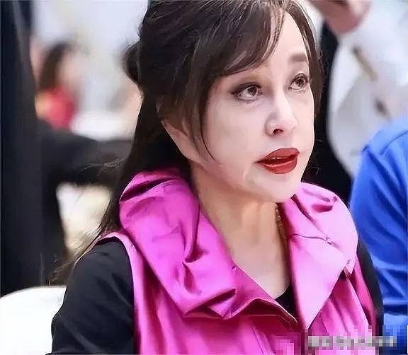 整容上瘾的6位女星，有人“换头改命”爆红，有人却断送了大好前途 - 14